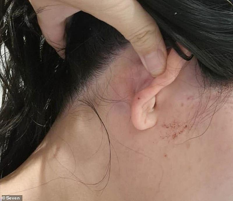  【深度复盘】堪培拉种族袭击事件：安全防身策略与法律应对全指南 新闻