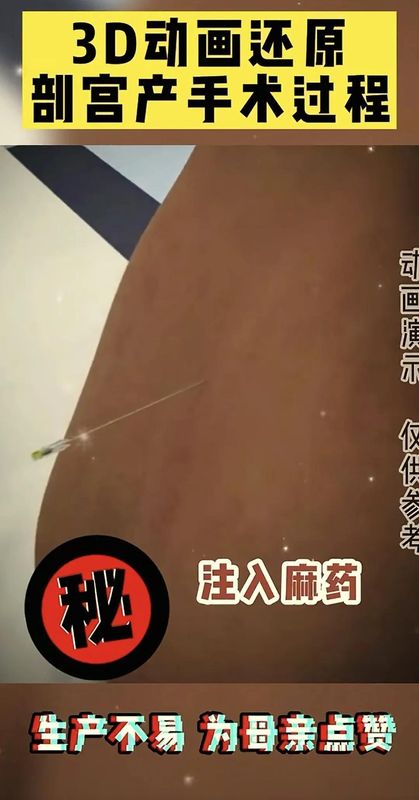 「生命故事·情感共鸣」：当妈后才懂——剖腹产那一刀，究竟划开了什么？